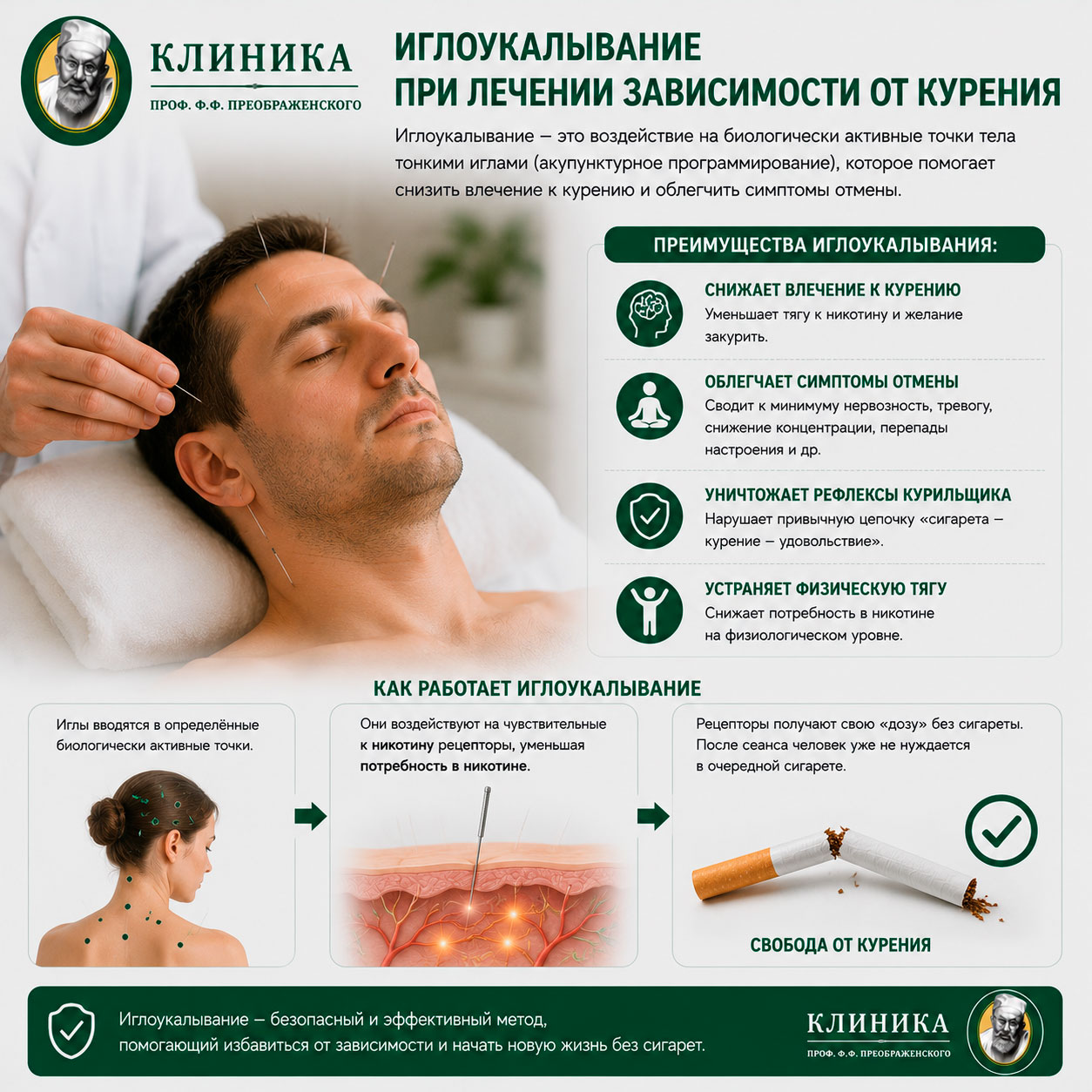 Иглоукалывание